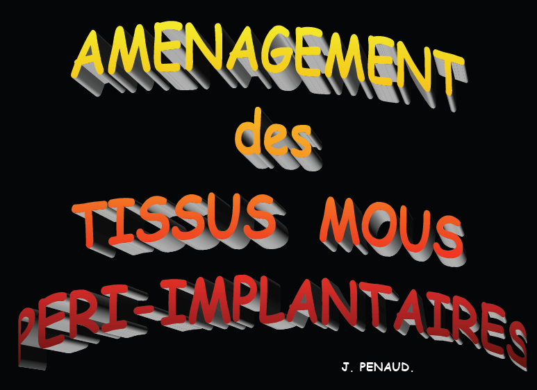 Aménagement des tissus mous péri-implantaires Impl10