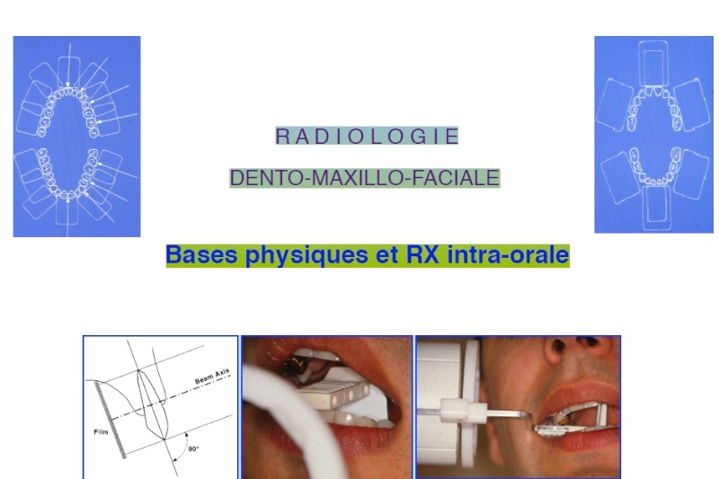 Bases physiques et Radiographie intra-orale  Radiol10