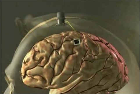 DOSSIER COMPLET : Les puces neurales et cérébrales et le "Brain Machine Interface Program" : DANGER! 410
