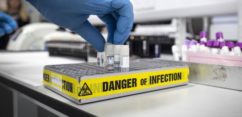 CORONAVIRUS: Le principal promoteur de la Chloroquine, le Dr Raoult, serait-il un fumiste sataniste? Corona11