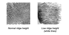 Fingerprint White Lines and Gluten Whitel10