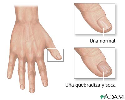 PROBLEMAS DE LAS UÑAS Uaas10