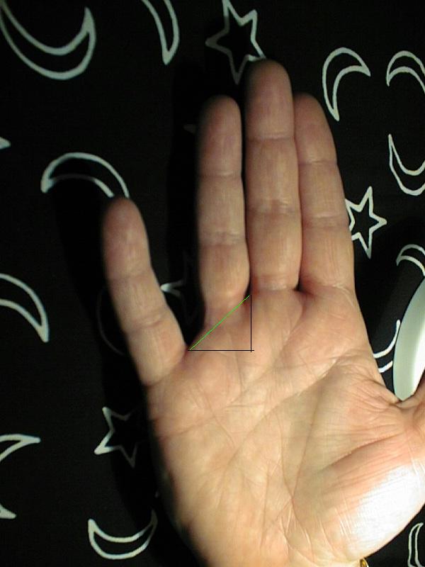 Low set finger (mercury finger) and meaning Rogers12