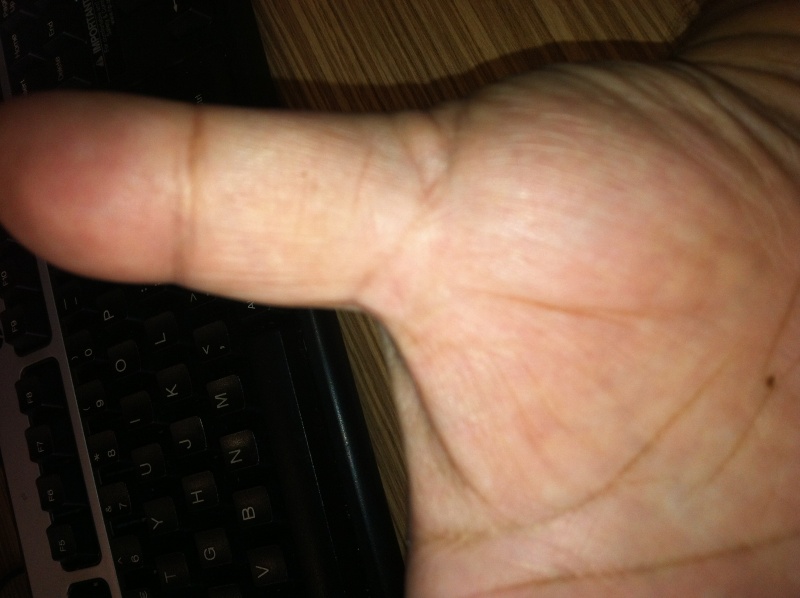 Many lines in my palm which has no reading reference anywhere - can someone help me please Img_0015