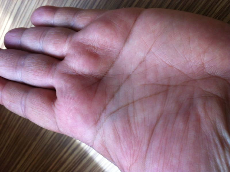 Many lines in my palm which has no reading reference anywhere - can someone help me please Pictur10