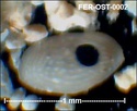 Ostracodes de FERCOURT (Oise)- ostracods Fer-os11