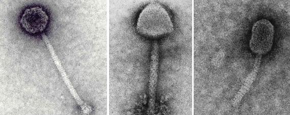 Quand un virus sauve une bactérie du suicide Phage10