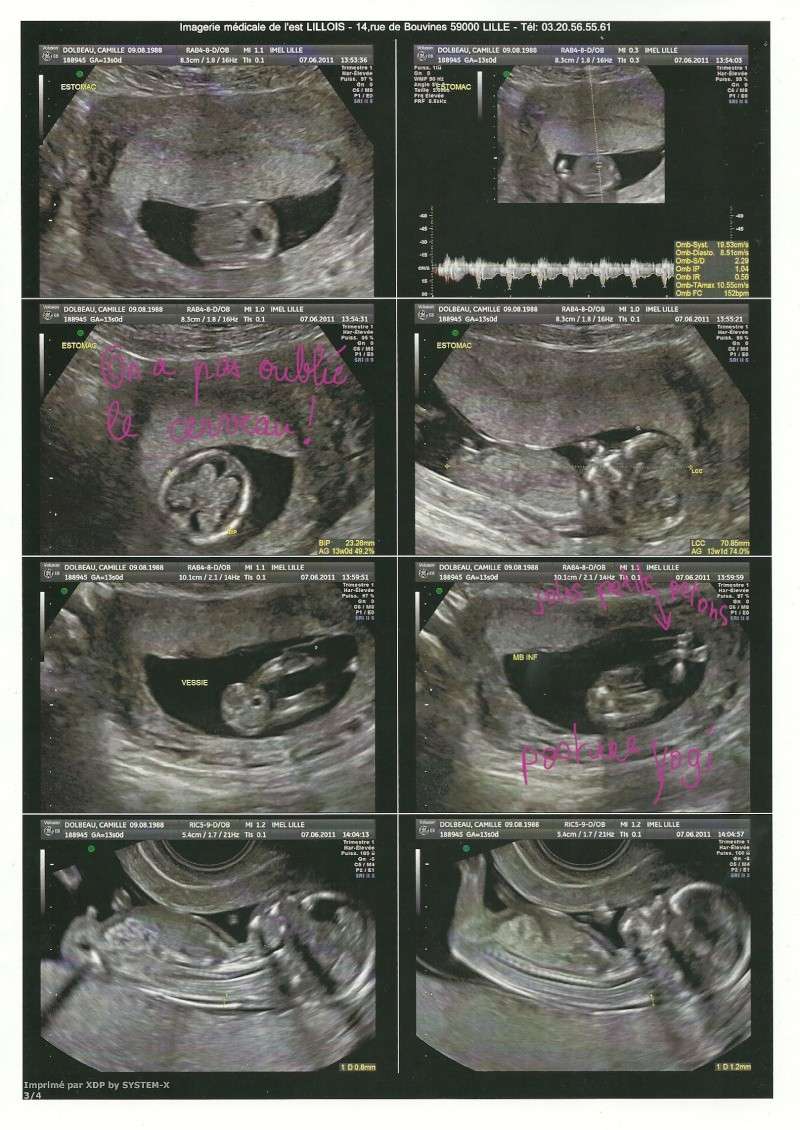 Enfants, grossesse, bibous et photos - Page 13 Baba310