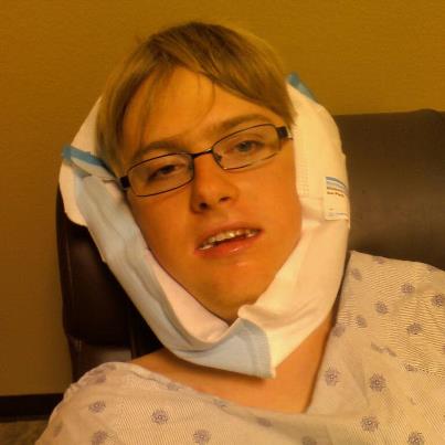 Wisdom Teeth Removal Tomorrow Photo13