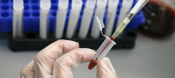 Une découverte prometteuse dans la recherche contre le sida Examen10
