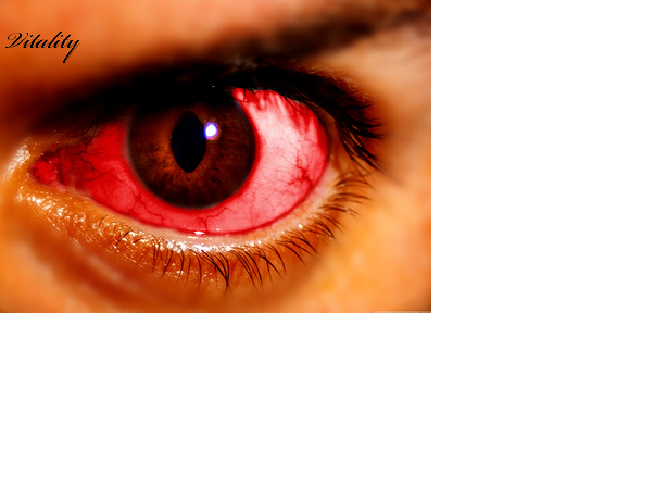 My eye lolol Bloody10