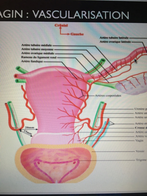 isthme/cervical en rapport avec artère ou uretère Image15