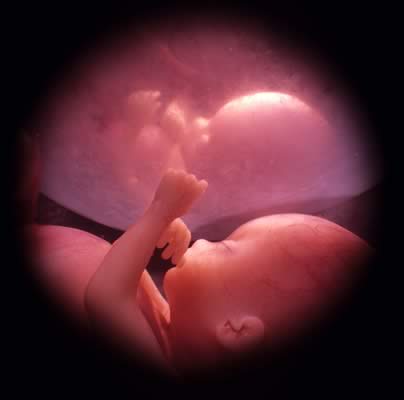 ABORTO CAMPAA PROVIDA PERU 2008(defendamos a los nios)VDEO DURISIMO..SINO ESTAS PREPARADA ..NO LO VEAS.. Fiv115
