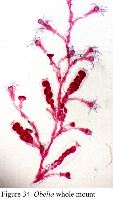 Tp : Les Cnidiares (Obelia geniculata) Obelia10