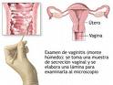 QUE ES LA VAGINOSIS? 1caxmy10