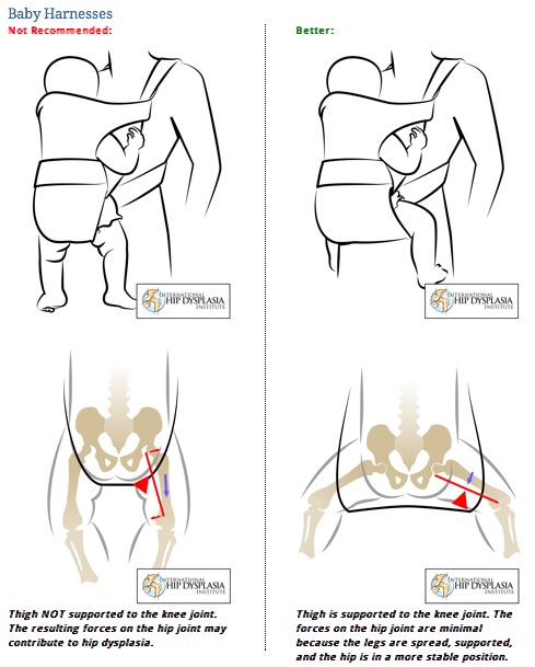Quel porte bébé dès la naissance? - Page 7 Hip1_t10