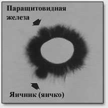 Энергетический акупунктурный диагноз (ЭАД) Манделя на основании кирлиан-снимков Topogr30