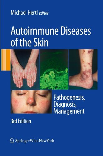 Autoimmune Diseases of the Skin: Pathogenesis, Diagnosis, Management, 3rd Edition G2h2lt10