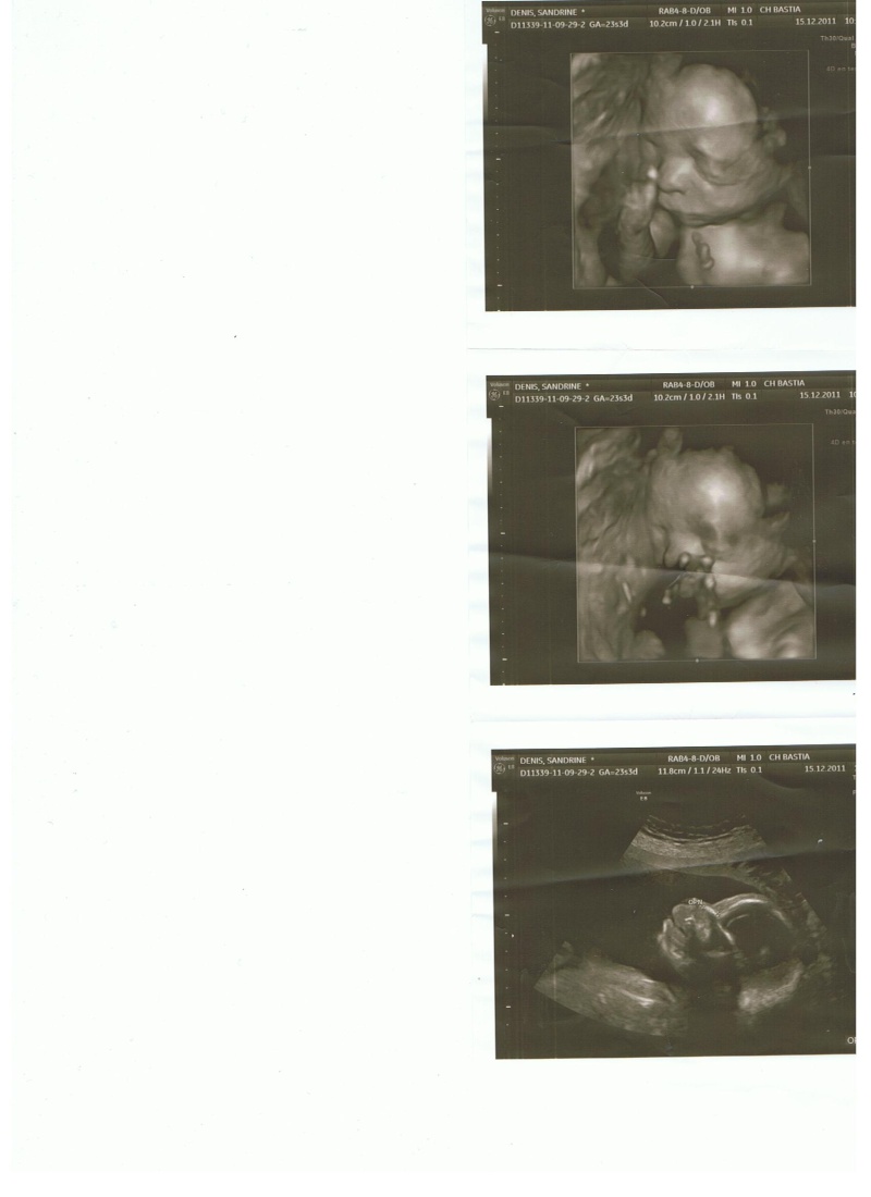 Enfants, grossesse, bibous et photos - Page 23 Bb3_2310