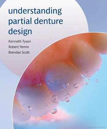 Understanding Partial Denture Design Upd10