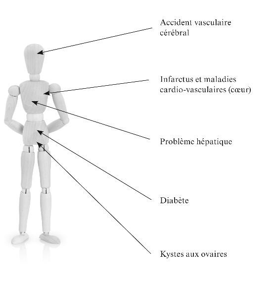 Le syndrome de la "bedaine" ou syndrome métabolique Ccc10