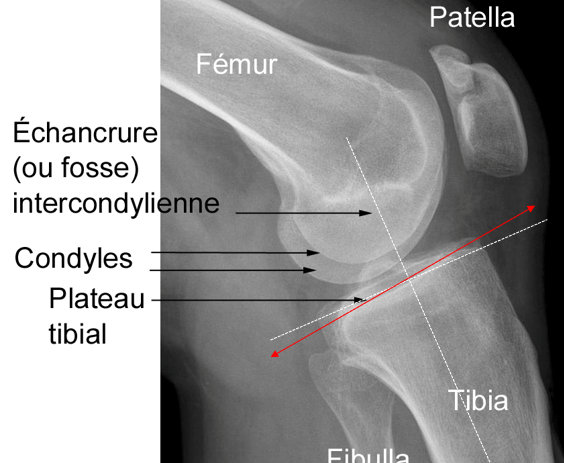 Face crâniale de l'épiphyse proximale du tibia Platea10