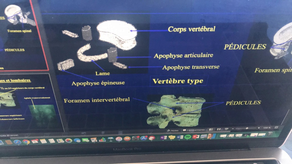 processus articulaires postérieurs Mr Ficheux 56580410