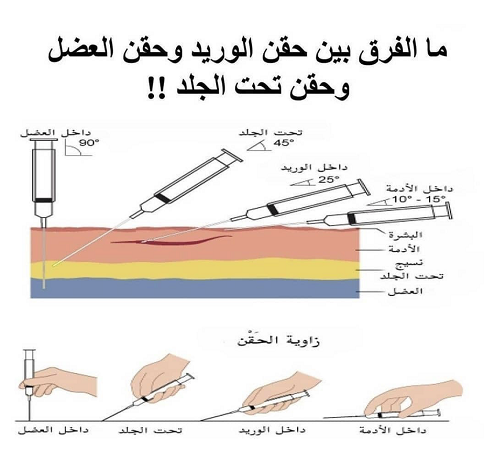 هل تعلمين ما الفرق بين حقن الوريد وحقن العضل وحقن تحت الجلد Img_9816