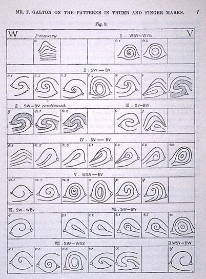 COMPOSITES (Loops / Whorls): Central Pockets, Lateral Pockets, Twin Loops & Accidentals - Page 2 Galton11