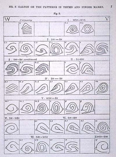 COMPOSITES (Loops / Whorls): Central Pockets, Lateral Pockets, Twin Loops & Accidentals - Page 2 Galton11