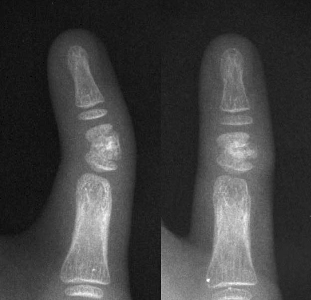 Strange bend of top planx of middle finger. Experts please? - Page 3 Jpg01110