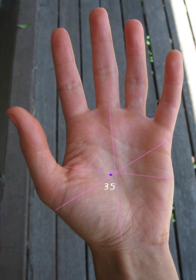 Spinal injuries showing in the hand? Kiwi_r10