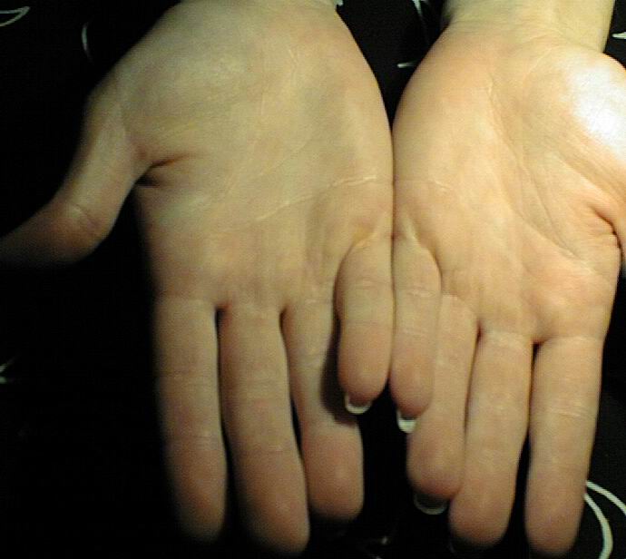 Low set finger (mercury finger) and meaning Luna_w11