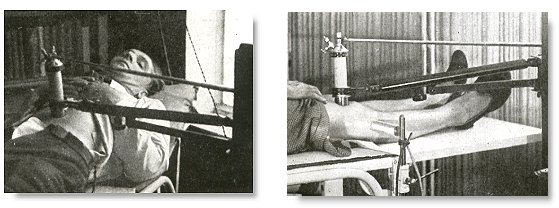 Ultrasound Therapy (The History of Ultrasound) Therap11