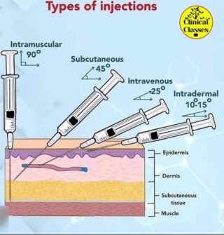  Qu’est-ce qu’une injection ? B2743611