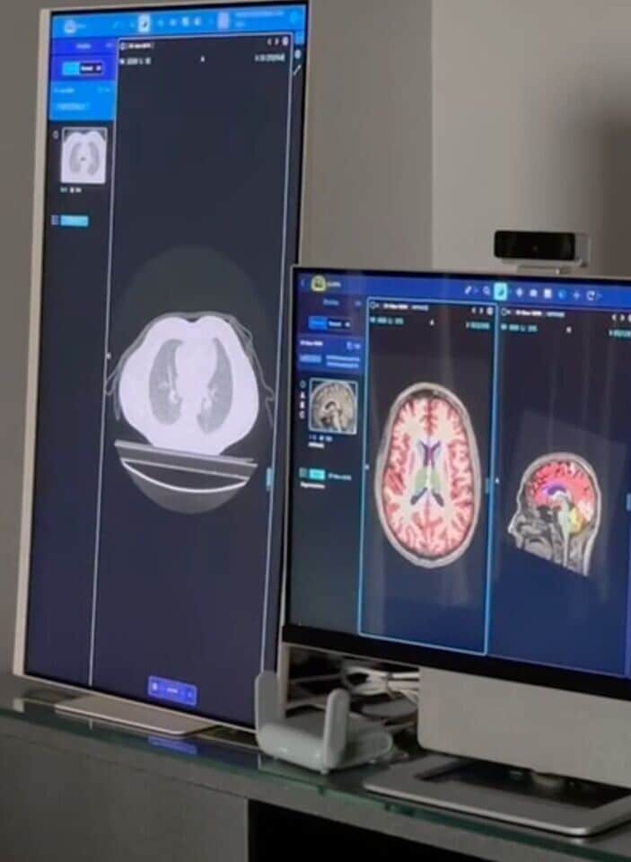 Alafia تقدم حاسوبًا متكاملًا لأجهزة التصوير الطبي بقوة معالجة مذهلة Alafia12