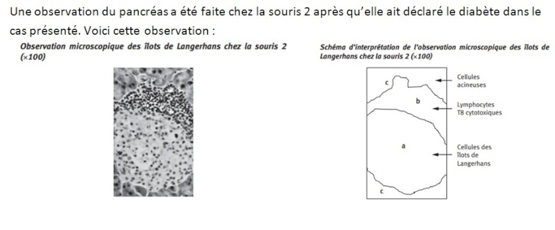 Chapitre 6 Les diabètes: une régulation glycémique anormale Pancre10