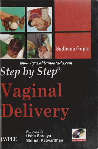 Vaginal Delivery by Sadhana Gupta 94411