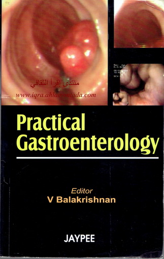 Practical Gastroenterology  E_110