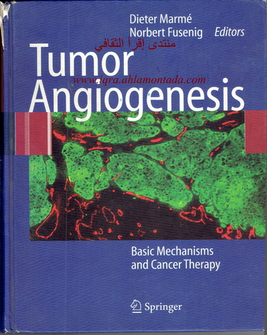 Tumor Angiogenesis Basic Mechanissms and Cancer Therapy  E_313