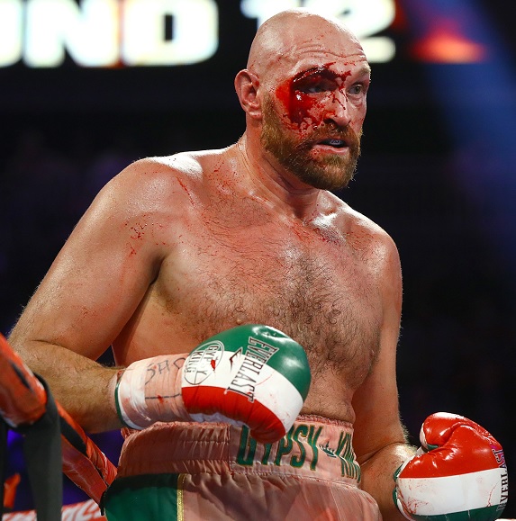 A Bloodied Fury Wins, But More Uncertainty For The Heavyweight Division Looms Tyson_12