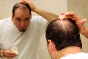 وصفات لعلاج الصلع والوقاية من حدوثة Hair1-10