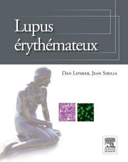 Lupus érythémateux 97822915