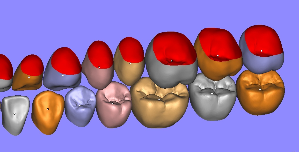 Bibliothèque de dents exocad 211