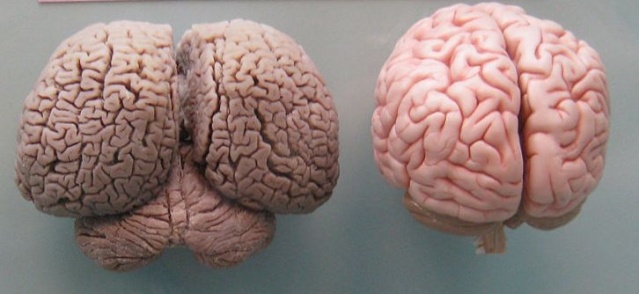 Que el cerebro humano es el cerebro más grande del Reino Animal es una de las grandes mentiras de la medicina Elcere10