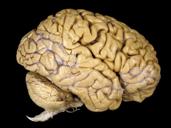 Que el cerebro humano es el cerebro más grande del Reino Animal es una de las grandes mentiras de la medicina Human-10