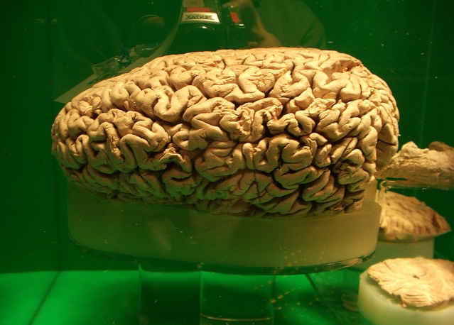 Que el cerebro humano es el cerebro más grande del Reino Animal es una de las grandes mentiras de la medicina Preser10