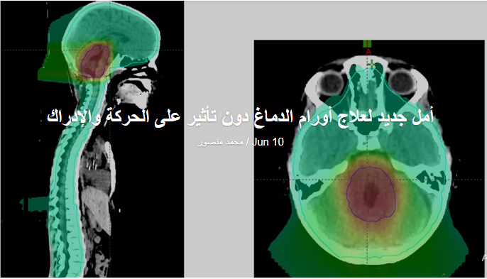 دراسة: حمض دهني يقتل خلايا السرطان 988