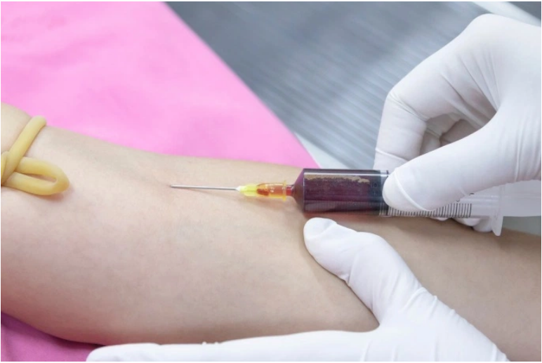 اختبار بسيط للدم ينبئ بالنوبة القلبية قبل عشر سنوات Yoo10