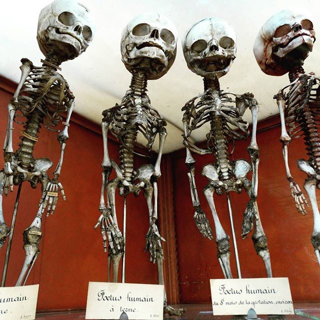 Crânes humain et divers Real Human Skulls Skull for sale 15803410